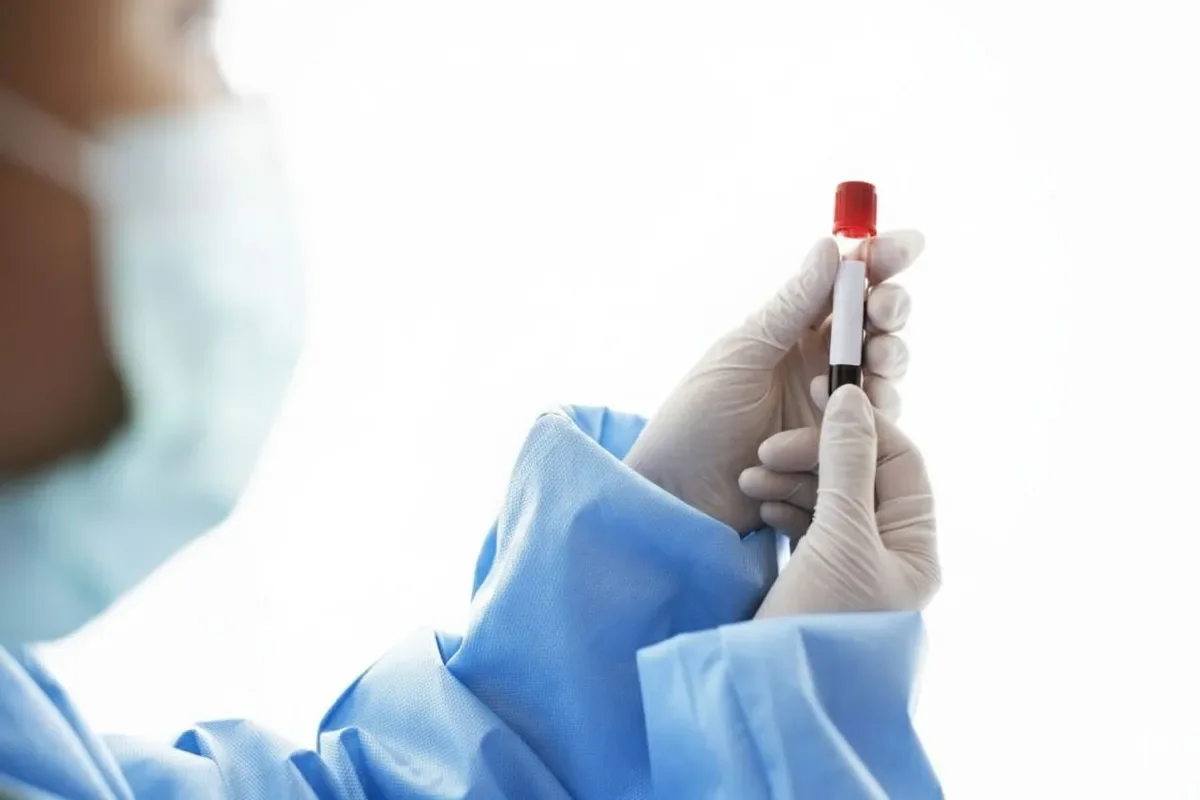 Hepatitis A Cases in the Czech Republic Continue to Rise – Already at the Highest Level in Almost 30 Years