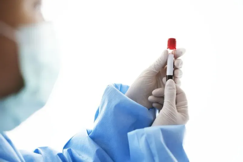 Hepatitis A Cases in the Czech Republic Reach 15-Year High